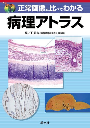 正常画像と比べてわかる病理アトラス 正常画像と比べてわかる病理アトラス
