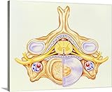ジョン・Bavosiプレミアムシックラップキャンバス壁アート印刷題名のアートワークCervical Vertebraから人間脊椎 30" x 24" 1153233_24_30x24_none