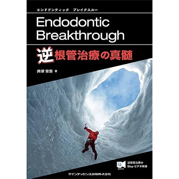 Amazon.co.jp: 外科的根管治療の必要性 : 井澤 常泰, 吉岡 隆知: 本