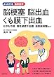 脳梗塞 脳出血 くも膜下出血 (よくわかる最新医学)