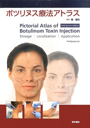 ボツリヌス療法アトラス