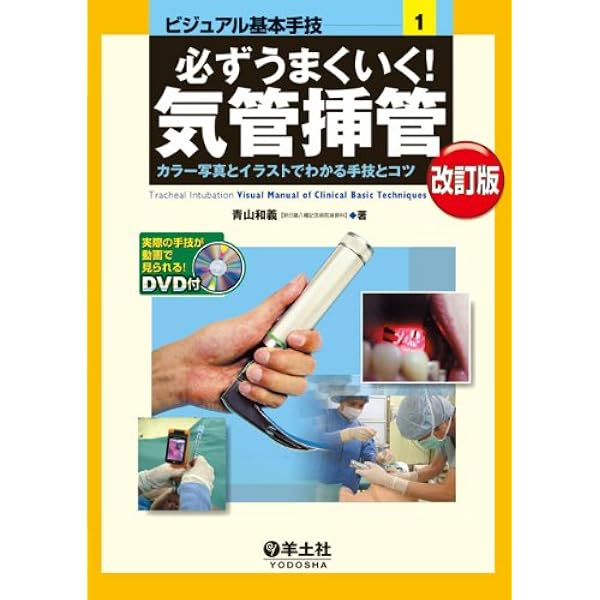 気管挿管 手技ガイド