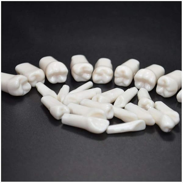 深在性う蝕に対するVital Pulp Therapy: 歯髄保存か抜髄かは患者のため