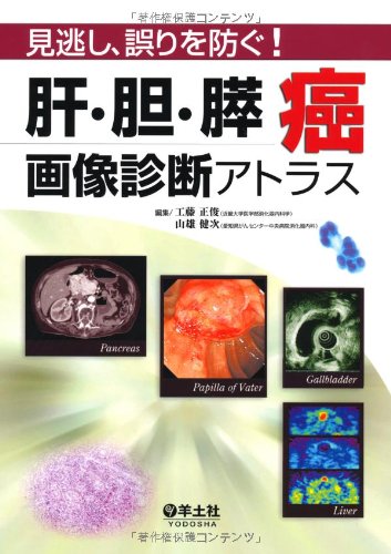 肝・胆・膵癌画像診断アトラス―見逃し、誤りを防ぐ! 肝・胆・膵癌画像診断アトラス―見逃し、誤りを防ぐ!