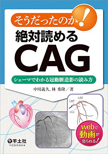 そうだったのか! 絶対読めるCAG〜シェーマでわかる冠動脈造影の読み方 そうだったのか! 絶対読めるCAG〜シェーマでわかる冠動脈造影の読み方