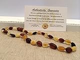 Baltic Amber Teething Necklace for Babies (Unisex) - Anti Flammatory, Drooling & Teething Pain Reduc