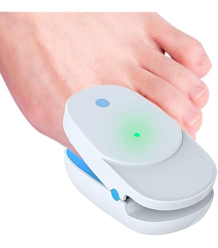 Amazon.co.jp: ニュー UVフットケア CUV-5 紫外線治療器 : ビューティー