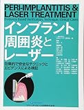 インプラント周囲炎とレーザー