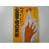 フィリピン心霊手術の真相