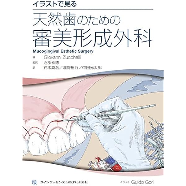 拡大写真で見る ペリオとインプラントのための審美形成外科 | Otto 