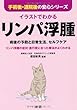 イラストでわかるリンパ浮腫―術後の予防と日常生活、セルフケア (手術後・退院後の安心シリーズ)