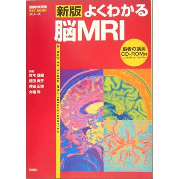 よくわかる脳MRI 第3版 (画像診断別冊KEYBOOK) | 青木茂樹, 相田