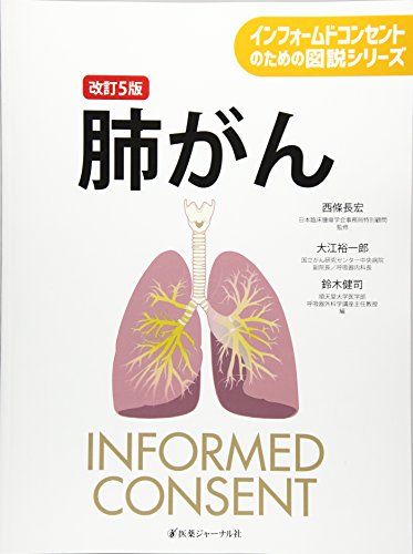 肺がん (インフォームドコンセントのための図説シリーズ) 肺がん (インフォームドコンセントのための図説シリーズ)