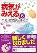 病気がみえる vol.6 免疫・膠原病・感染症