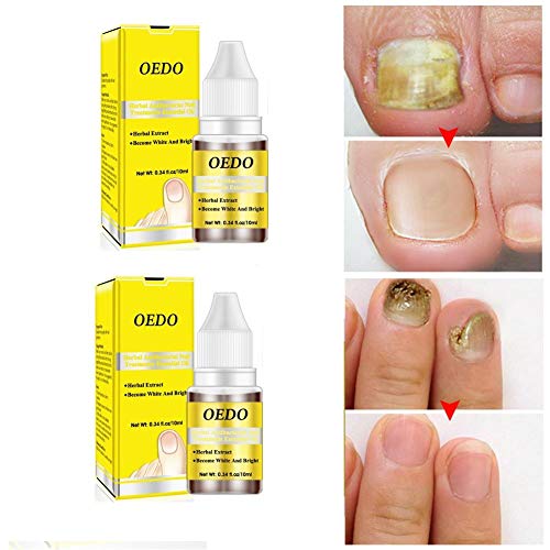 Mua ネイル補修液 10ml 2点セット 足爪用補修液 ネイルケアオイル