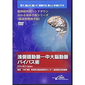 浅側頭動脈—中大脳動脈バイパス術(DVD) (脳神経外科ハンドダウン 伝わる基本手術シリーズ〈脳血管障害手術〉) 浅側頭動脈—中大脳動脈バイパス術(DVD) (脳神経外科ハンドダウン 伝わる基本手術シリーズ〈脳血管障害手術〉)