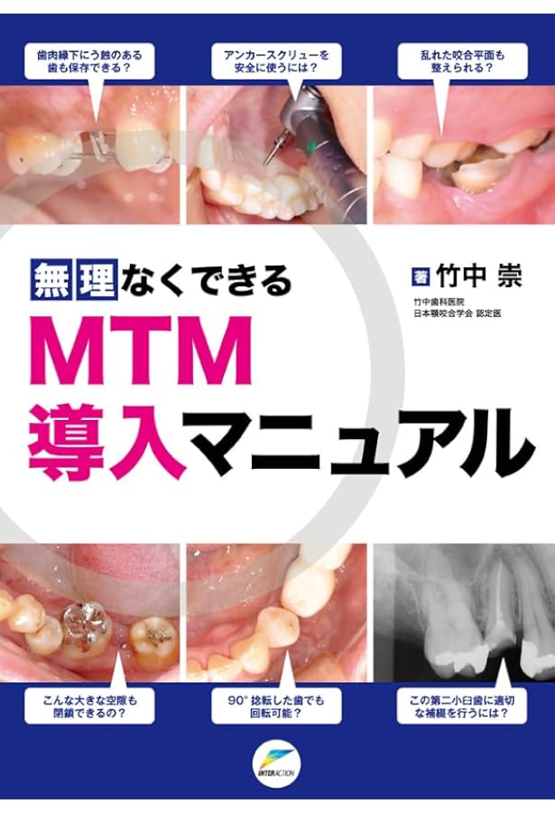 歯科　無理なくできるGP矯正治療導入マニュアル Amazon.co.jp: 無理なくできるGP矯正治療導入マニュアル : 寺本 清峰: 本