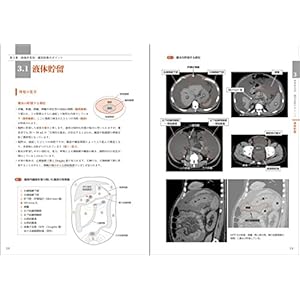 レジデントのための腹部画像教室