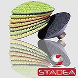 4" convex diamond polishing pads granite - Wet Concrete Glass Stone Marble Set By STADEA [並行輸入品]