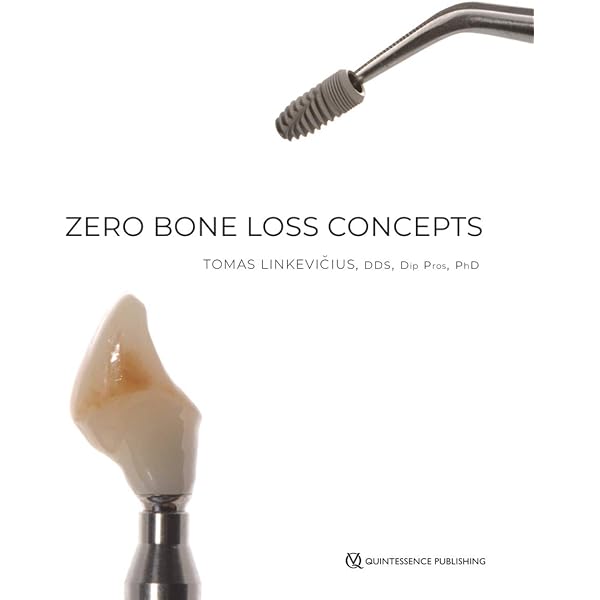 Amazon | Functional Occlusion: From TMJ to Smile Design | Dawson