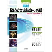 51ux3-A4r3L._AC_UL210_SR210,
