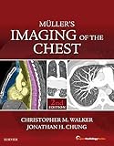 Muller's Imaging of the Chest E-Book: Expert Radiology Series