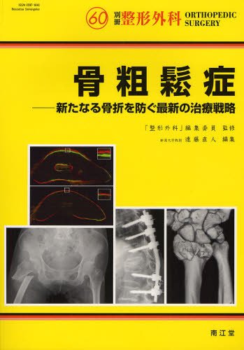 骨粗鬆症-新たなる骨折を防ぐ最新の治療戦略- (別冊整形外科 No.60) 骨粗鬆症-新たなる骨折を防ぐ最新の治療戦略- (別冊整形外科 No.60)