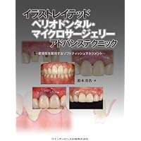 イラストレイテッド 歯冠修復 アドバンステクニック (イラストレイ