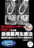 Er:YAGレーザーとFGF-2による低侵襲再生療法