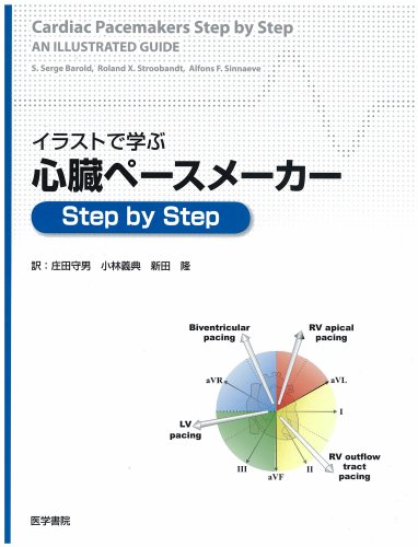 イラストで学ぶ心臓ペースメーカーstep by step イラストで学ぶ心臓ペースメーカーstep by step