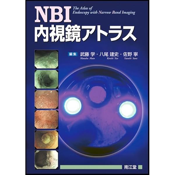 新訂NBI内視鏡アトラス | 武藤学, 八尾建史, 佐野寧 |本 | 通販 | Amazon