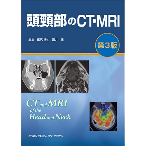 腹部のCT 第3版 | 陣崎雅弘 |本 | 通販 | Amazon