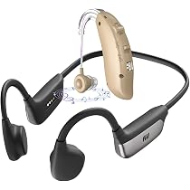 Amazon.co.jp: yete 美顔器 EMS美顔器 高周波美顔器 1台多役 4色LED 光
