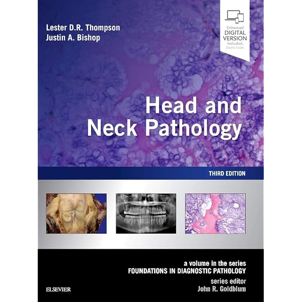 Amazon | Tumors of the Salivary Glands (AFIP Atlas of Tumor and