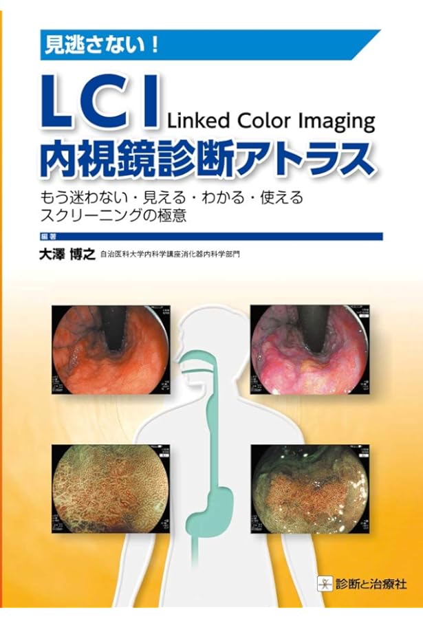 新訂NBI内視鏡アトラス | 武藤学, 八尾建史, 佐野寧 |本 | 通販 | Amazon
