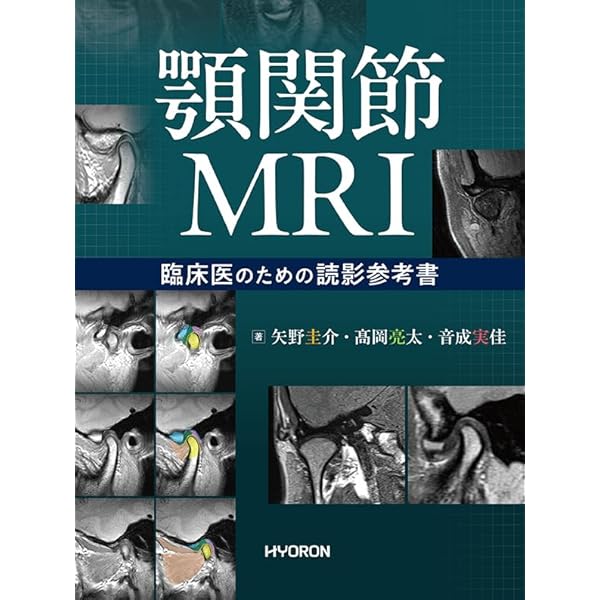 ガミースマイル: 11の要因 成功に導くトリートメントマップ