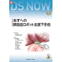 あすへの膵胆道ロボット支援下手術［Web動画付］ (新DS NOW 11
