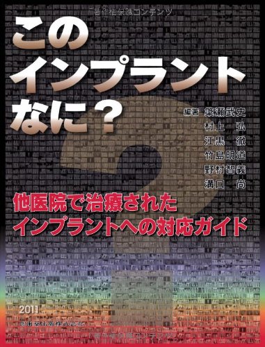 このインプラントなに?他医院で治療されたインプラントへの対応ガイド / 上野 温子,加藤 大輔,宮前 真,志賀 泰昭,荒木 久生