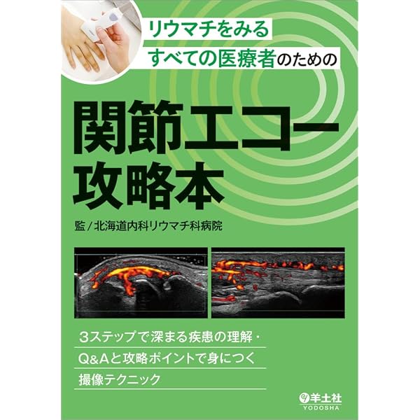 リウマチ診療のための筋骨格超音波検査 ―実践ガイド ― | 中込大樹