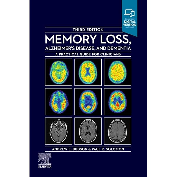 Memory Loss，Alzheimer&#39;s Disease and Dementia: A Practical Guide for Clinicians [ペーパーバック] Budson MD，Andrew E.; Solomon PhD，Paul R. Memory Loss, Alzheimer's Disease and Dementia: A Practical