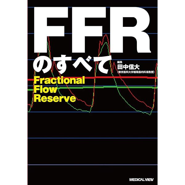Amazon.co.jp: PCIのための虚血評価 FFRスタンダードマニュアル