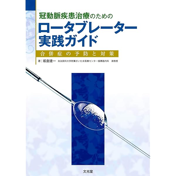 Amazon.co.jp: CTO-PCI 一期一会 難関攻略ノ心得 : 伊藤 良明