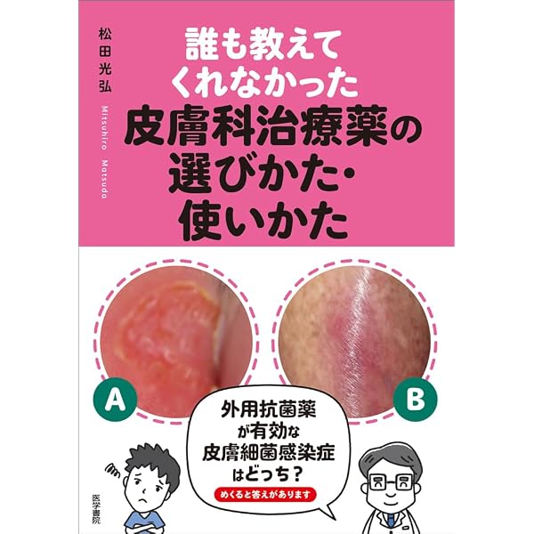 Amazon.co.jp: 好発部位でみる皮膚疾患アトラス 頭部・顔: 頭頚部