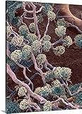 スティーブ・Gschmeissnerプレミアムシックラップキャンバス壁アート印刷題名腎臓glomeruli、Sem 30" x 40" 1153745_24_30x40_none