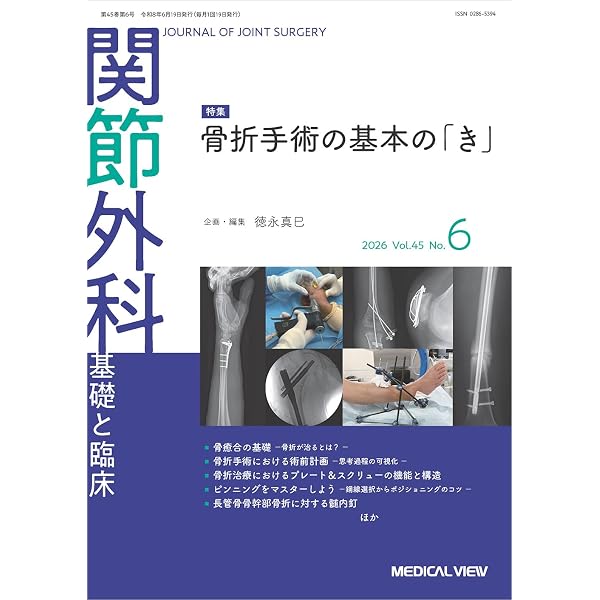 改訂第2版 骨折 髄内固定治療マイスター | 澤口 毅 |本 | 通販 | Amazon