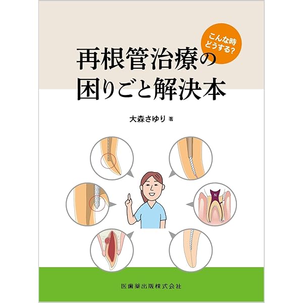 根管治療トラブル攻略本 完全解説 根管治療トラブル攻略本: エンドのよくある24の難局面大攻略