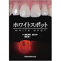 ホワイトスポット | 指宿 隆秀, 品川 淳一, 保坂 啓一 |本 | 通販 | Amazon
