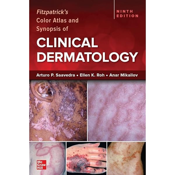 Amazon | Lookingbill and Marks' Principles of Dermatology | Marks