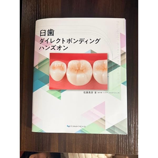 Amazon.co.jp: 臼歯ダイレクトボンディング ハンズオン : 佐藤貴彦: 本