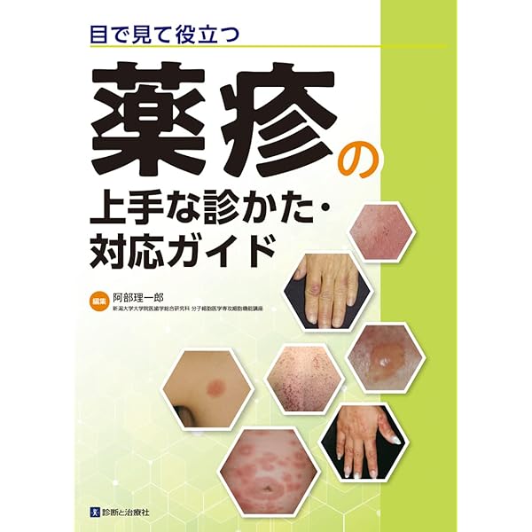 薬疹診療のフロントライン (診る・わかる・治す皮膚科臨床アセット 